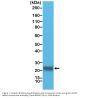 Anti-GST3/GST pi GSTP1 Rabbit Monoclonal Antibody, Clone#RM347