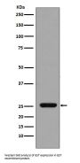 Anti-GST GSTP1 Rabbit Monoclonal Antibody