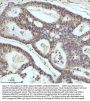 Anti-53BP1 TP53BP1 Rabbit Monoclonal Antibody