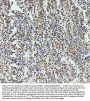 Anti-53BP1 TP53BP1 Rabbit Monoclonal Antibody