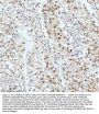 Anti-53BP1 TP53BP1 Rabbit Monoclonal Antibody