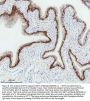 Anti-Cytokeratin 5 KRT5 Rabbit Monoclonal Antibody