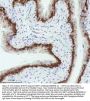 Anti-Cytokeratin 5 KRT5 Rabbit Monoclonal Antibody