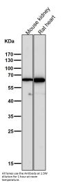 Anti-Cytokeratin 5 KRT5 Rabbit Monoclonal Antibody