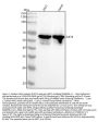Anti-Cytokeratin 5 KRT5 Rabbit Monoclonal Antibody