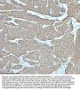 Anti-Cytokeratin 5 KRT5 Rabbit Monoclonal Antibody