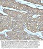 Anti-Cytokeratin 5 KRT5 Rabbit Monoclonal Antibody