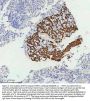Anti-Cytokeratin 5 KRT5 Rabbit Monoclonal Antibody