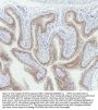 Anti-Cytokeratin 5 KRT5 Rabbit Monoclonal Antibody