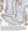Anti-Cytokeratin 5 KRT5 Rabbit Monoclonal Antibody
