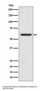 Anti-Cytokeratin 5 (C-term) KRT5 Rabbit Monoclonal Antibody