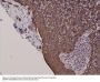 Anti-Cytokeratin 5 Rabbit Monoclonal Antibody, Clone#RM226