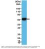 Anti-CK-5/CK-6 (Cytokeratin 5/ Cytokeratin 6) Rabbit Monoclonal Antibody, Clone#RM341