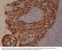 Anti-CK-5/CK-6 (Cytokeratin 5/ Cytokeratin 6) Rabbit Monoclonal Antibody, Clone#RM341