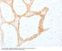 Anti-Cytokeratin 5/8 KRT5 Monoclonal Antibody