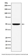 Anti-MUM1 Monoclonal Antibody