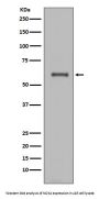 Anti-NOX4 Rabbit Monoclonal Antibody