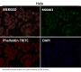 Anti-NOX4 Rabbit Monoclonal Antibody