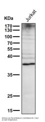 Anti-DR5 Rabbit Monoclonal Antibody