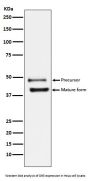Anti-DR5 Rabbit Monoclonal Antibody