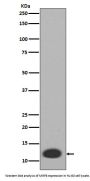 Anti-MRP8 S100A8 Rabbit Monoclonal Antibody