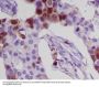 Anti-MRP8 S100A8 Rabbit Monoclonal Antibody