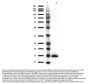 Anti-IL-17A Monoclonal Antibody