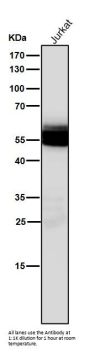 Anti-Lck Monoclonal Antibody