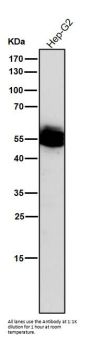 Anti-Lck Monoclonal Antibody