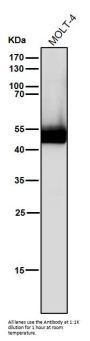 Anti-Lck Monoclonal Antibody