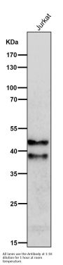 Anti-SIRT2/Sirtuin 2 Rabbit Monoclonal Antibody