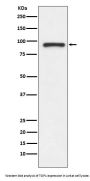 Anti-TOP1/Topoisomerase I Rabbit Monoclonal Antibody