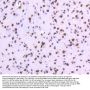 Anti-TOP1/Topoisomerase I Rabbit Monoclonal Antibody