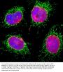 Anti-Lamin A/C LMNA Monoclonal Antibody