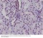 Anti-Lamin A/C LMNA Rabbit Monoclonal Antibody