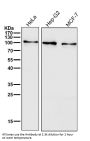 Anti-Insulin Receptor INSR Rabbit Monoclonal Antibody