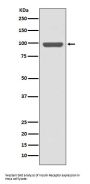 Anti-Insulin Receptor INSR Rabbit Monoclonal Antibody