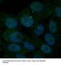 Anti-Insulin Receptor INSR Rabbit Monoclonal Antibody