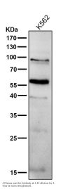Anti-PPAR gamma Rabbit Monoclonal Antibody