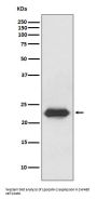 Anti-Lipocalin-2 LCN2 Rabbit Monoclonal Antibody