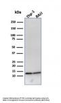 Anti-Beta-2 Microglobulin (Renal Failure & Tumor Marker) B2M Monoclonal Antibody
