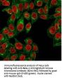 Anti-Beta-2 Microglobulin (Renal Failure & Tumor Marker) B2M Monoclonal Antibody