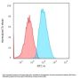 Anti-Beta-2 Microglobulin (Renal Failure & Tumor Marker) B2M Monoclonal Antibody