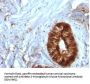 Anti-Beta-2 Microglobulin (Renal Failure & Tumor Marker) B2M Monoclonal Antibody