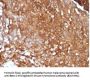 Anti-Beta-2 Microglobulin (Renal Failure & Tumor Marker) B2M Monoclonal Antibody