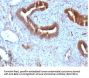 Anti-Beta-2 Microglobulin (Renal Failure & Tumor Marker) B2M Monoclonal Antibody