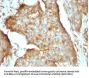 Anti-Beta-2 Microglobulin (Renal Failure & Tumor Marker) B2M Monoclonal Antibody