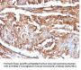 Anti-Beta-2 Microglobulin (Renal Failure & Tumor Marker) B2M Monoclonal Antibody