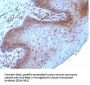Anti-Beta-2 Microglobulin (Renal Failure & Tumor Marker) B2M Monoclonal Antibody