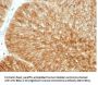 Anti-Beta-2 Microglobulin (Renal Failure & Tumor Marker) B2M Monoclonal Antibody
